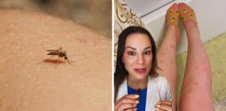 Especialista revela as razões pela qual os mosquitos “gostam” muito mais de algumas pessoas do que de outras