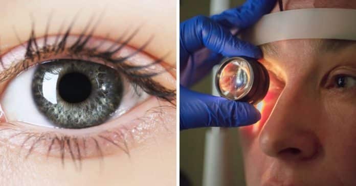 Cientistas revelam que existe uma nova cor de olhos rara: Apenas 1% da população possui