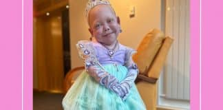 Morre aos 10 anos Bella Brave, influencer com doença rara que tinha corpo de bebê