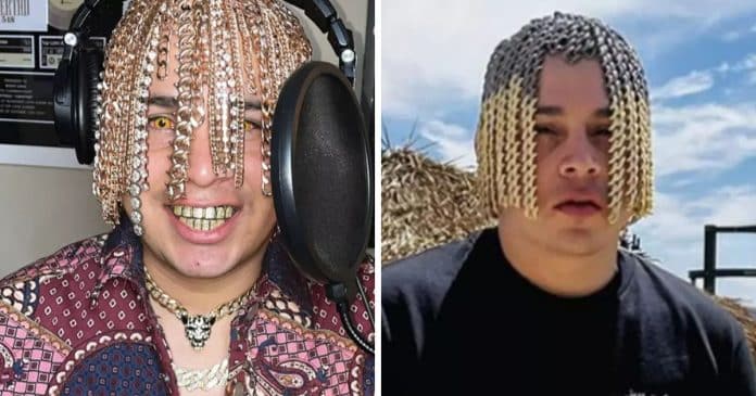 Rapper enfrenta sérios riscos após implantar correntes de ouro em sua cabeça como se fossem cabelo