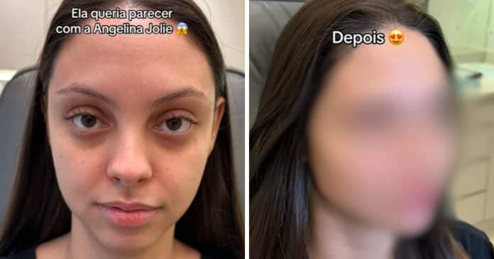 VÍDEO: Jovem faz harmonização facial para ficar parecida com Angelina Jolie e resultado impressiona