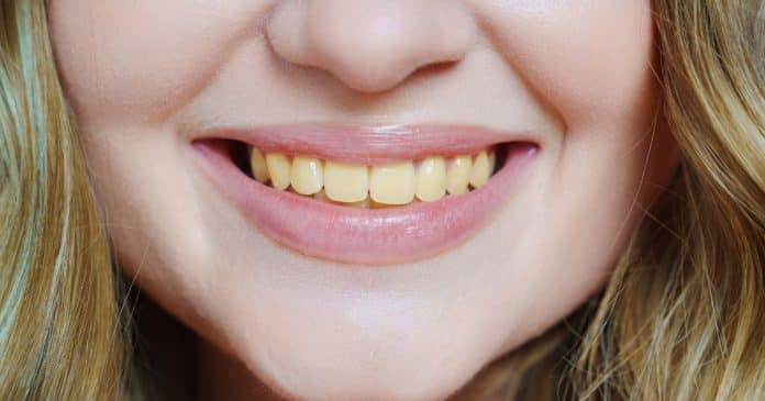 Estes são os principais motivos de por quê seus dentes estão amarelados – e como evitar?